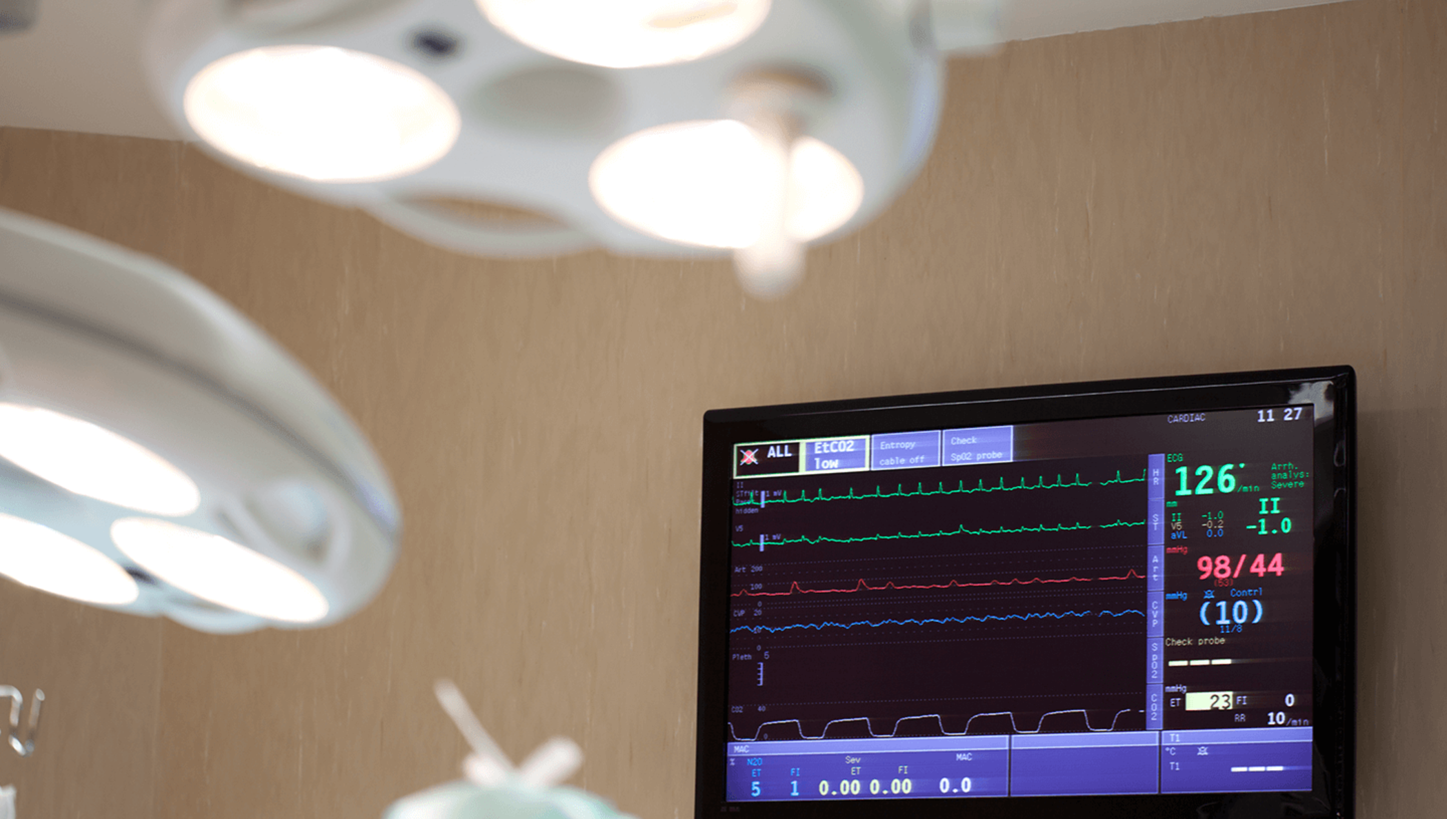 Ein Herzfrequenzmesser in einem Krankenzimmer.